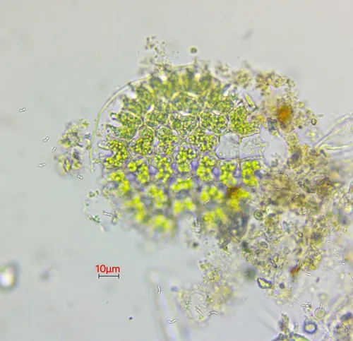 Pediastrum angulosum