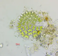 Pediastrum angulosum thumbnail 1