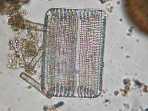 Rhabdonema arcuatum