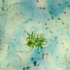 Selenastrum bibraianum thumbnail 2