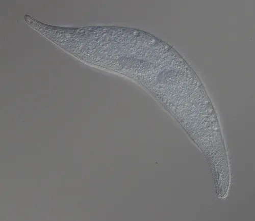 Amphileptus pleurosigma