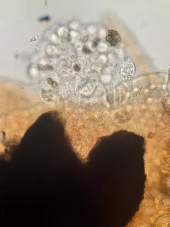 Pleostigma jungermannicola thumbnail 2