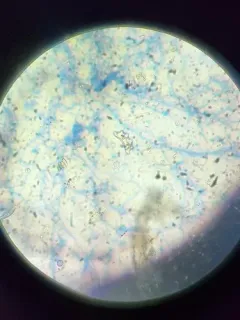 Eunotia tetraodon thumbnail 1