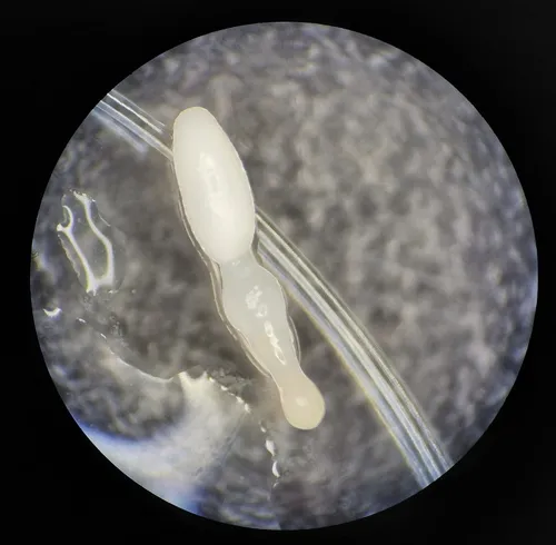Profilicollis botulus