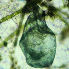 Stentor coeruleus thumbnail 2