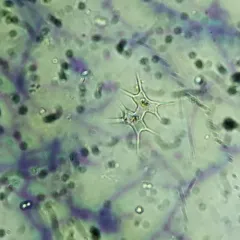 Staurodesmus octocornis thumbnail 3