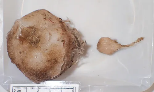 Thenea muricata