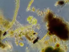 Stephanosphaera pluvialis thumbnail 1