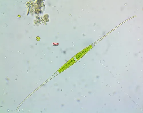 Closterium setaceum