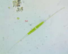 Closterium setaceum thumbnail 1