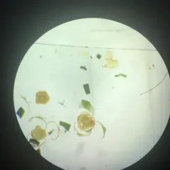 Bog Haircap Moss thumbnail 2