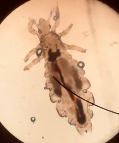 Human Louse thumbnail 2