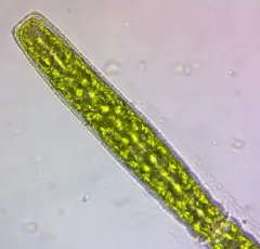 Pleurotaenium coronatum thumbnail 1