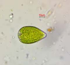 Gonyostomum semen thumbnail 3