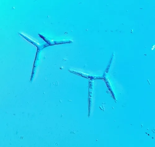 Tricladium angulatum