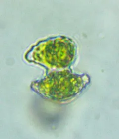 Staurastrum margaritaceum thumbnail 1