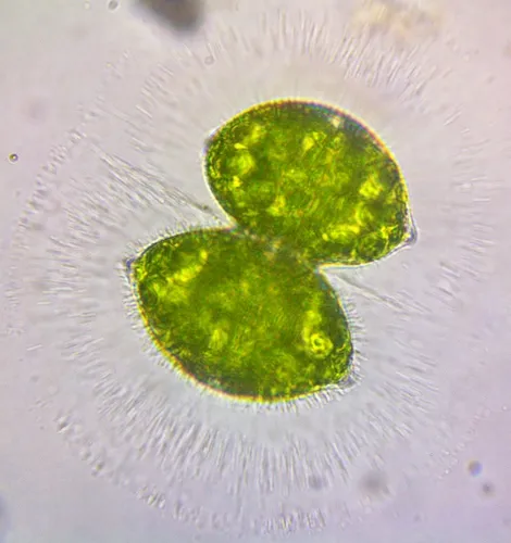 Xanthidium tumidum