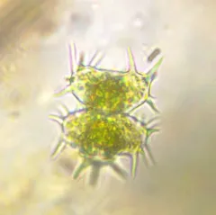 Staurastrum hystrix thumbnail 4