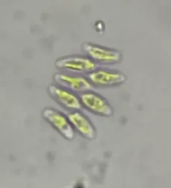 Scenedesmus obtusus thumbnail 2