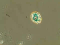 Paulinella chromatophora thumbnail 3