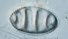 Surirella undulata thumbnail 1