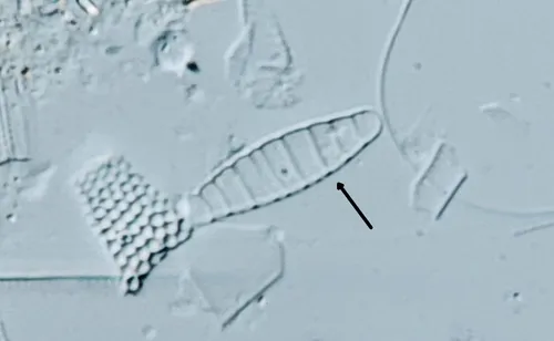 Diatoma moniliformis