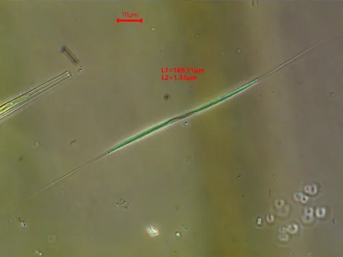 Monoraphidium komarkovae