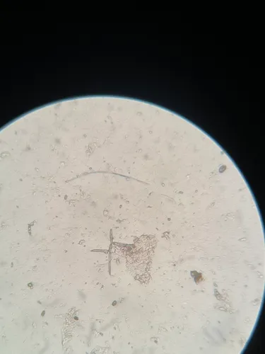 Articulospora tetracladia