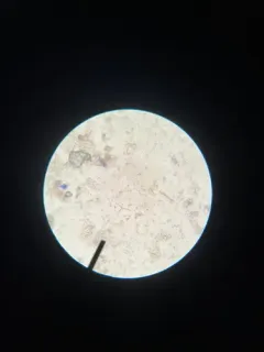 Alatospora acuminata thumbnail 2