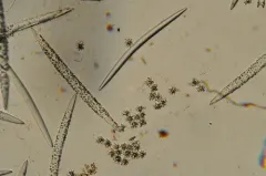 Ephydatia muelleri thumbnail 2