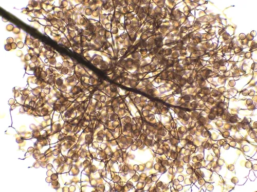 Paradiacheopsis longipes