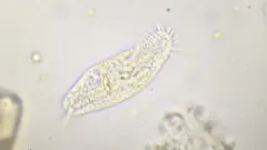 Holosticha pullaster thumbnail 1