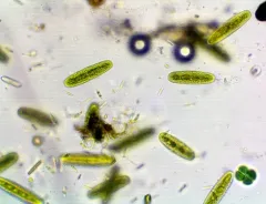Netrium oblongum thumbnail 3