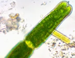 Tetmemorus brebissonii thumbnail 2