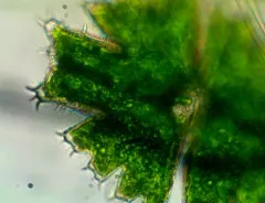 Micrasterias brachyptera thumbnail 1