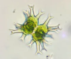 Staurastrum tohopekaligense thumbnail 2