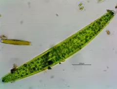 Closterium lunula thumbnail 1