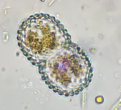 Cosmarium amoenum thumbnail 3