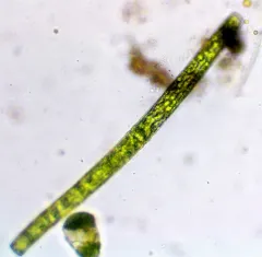 Pleurotaenium ehrenbergii thumbnail 3