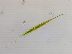 Closterium rostratum thumbnail 2