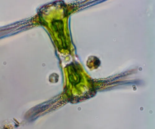 Staurastrum ankyroides