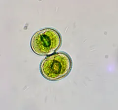 Cosmarium contractum thumbnail 2