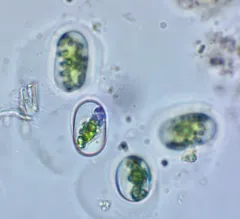 Mesotaenium macrococcum thumbnail 3
