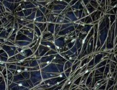 Pale-footed Horsehair Lichen thumbnail 2