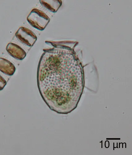 Dinophysis acuminata