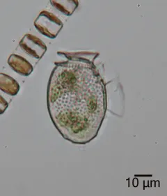 Dinophysis acuminata thumbnail 1