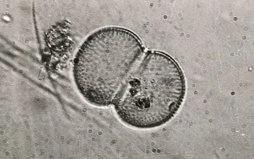 Cosmarium connatum
