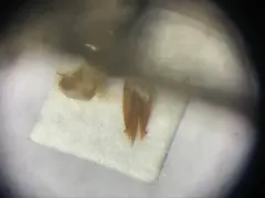 Sorrowful Click Beetle thumbnail 2