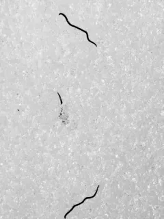 Mesenchytraeus solifugus thumbnail 4