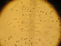Polyozellus atrolazulinus thumbnail 3